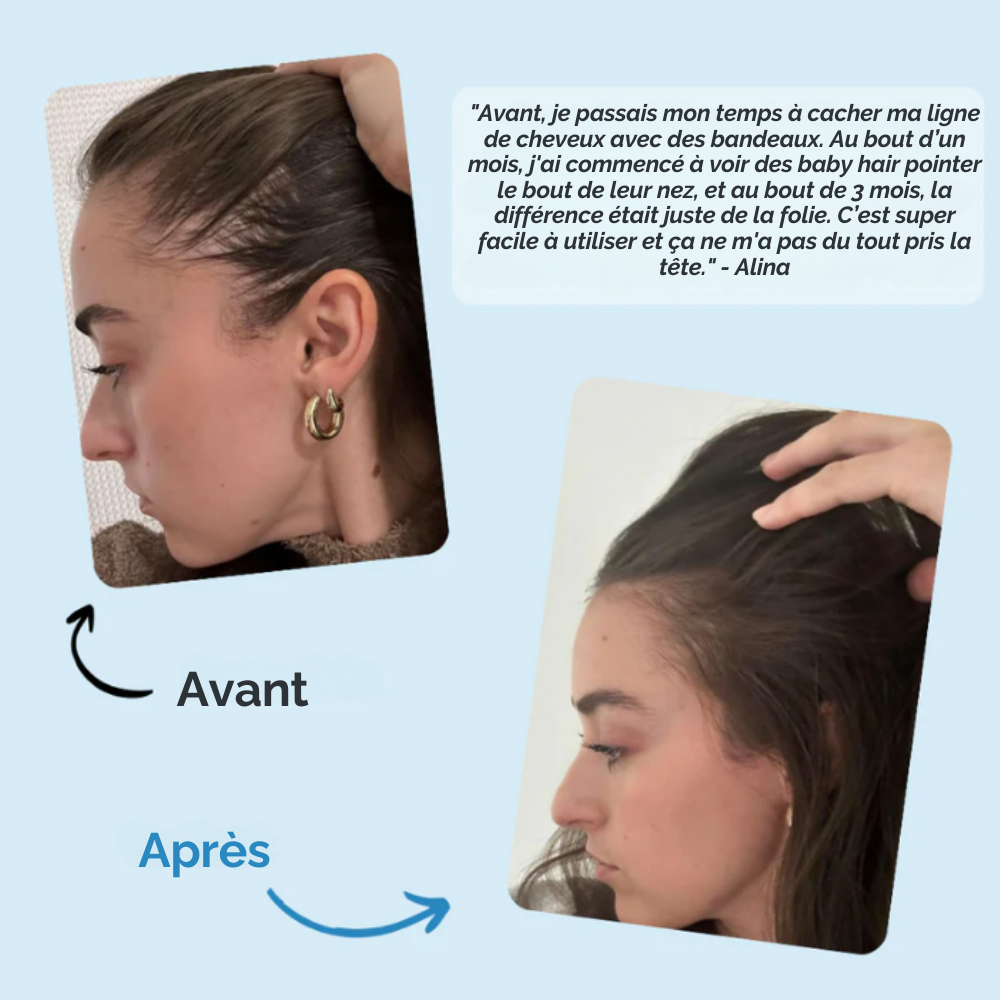 Sérum Roll-on Repousse Ciblée Reivita – Repousse des tempes et golfes dégarnis